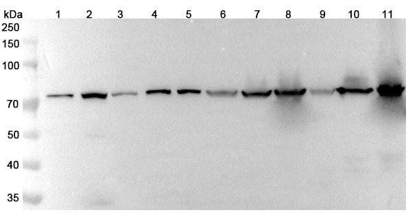 Anti-ANXA6 Polyclonal antibody binds to Recombinant Human ANXA6, N-His in WB Assay