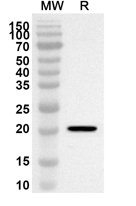 Anti-APRT Polyclonal antibody binds to Recombinant Human APRT, N-His in WB Assay