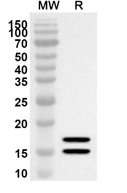 Anti-AREG Polyclonal antibody binds to Human AREG Recombinant Protein, N-GST & C-His in WB Assay