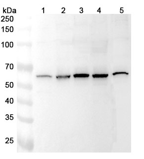 Anti-ARIH2 Polyclonal Antibody binds to Human ARIH2 Recombinant Protein, N-His in WB Assay