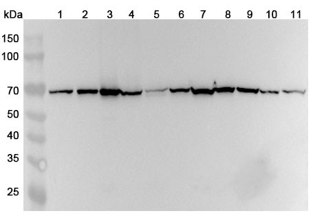 Anti-ATIC Polyclonal Antibody binds to Human ATIC Recombinant Protein, N-His in WB Assay