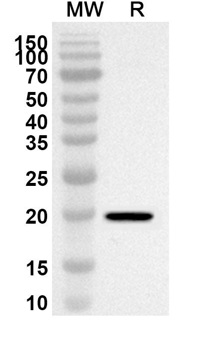 Anti-ATP5F1D Polyclonal Antibody binds to Recombinant Human ATP5F1D, N-His in WB Assay