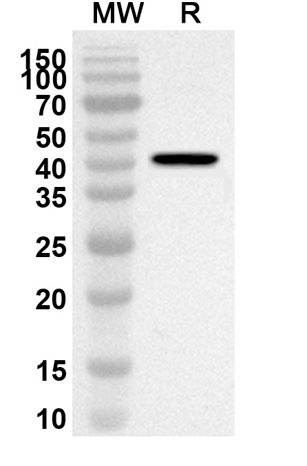 Anti-AZIN2 Polyclonal Antibody binds to Recombinant Human AZIN2, N-His in WB Assay