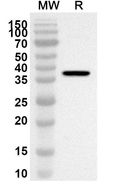 Anti-Bacillus cereus gajA Polyclonal Antibody binds to Recombinant Bacillus cereus gajA Protein, N-His in WB Assay