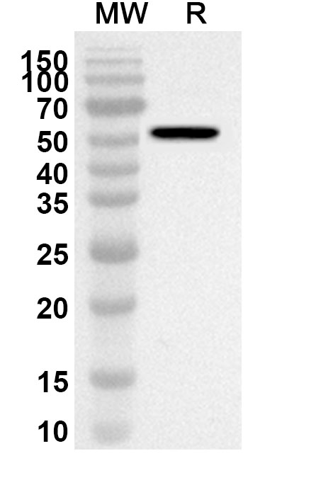 Anti-BCCV Gc/Glycoprotein C Polyclonal Antibody binds to Recombinant BCCV Gn/Glycoprotein N Protein, N-His in WB Assay