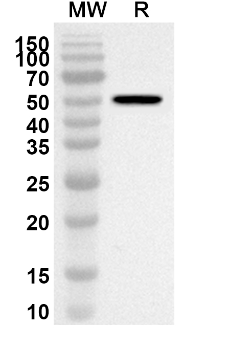 Anti-BCCV Gn/Glycoprotein N Polyclonal Antibody binds to Recombinant BCCV Gn/Glycoprotein N Protein, N-His in WB Assay