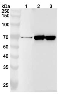 Anti-BCHE Polyclonal Antibody binds to Recombinant Human BCHE, N-His in WB Assay