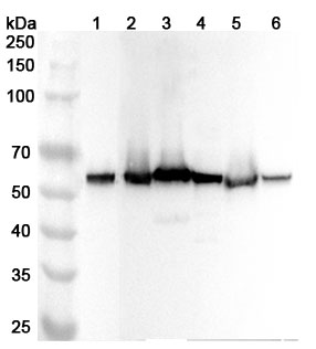 Anti-BECN1 Polyclonal antibody binds to Recombinant Human BECN1 Protein, N-His in WB Assay