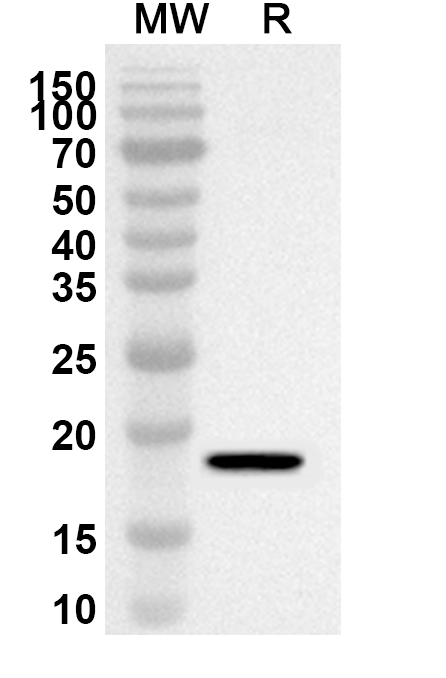Anti-BRMS1L Polyclonal Antibody binds to Recombinant Human BRMS1L Protein, N-His in WB Assay