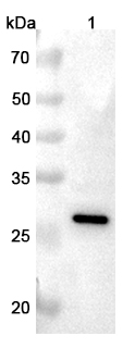 Anti-C1QA Polyclonal antibody binds to Recombinant Human C1QA, N-His in WB Assay