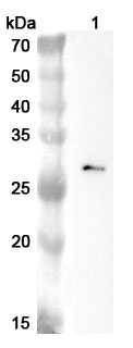 Anti-C1QC Polyclonal antibody binds to Recombinant Human C1QC, N-His in WB Assay
