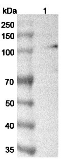 Anti-C6 Polyclonal antibody binds to Recombinant Human C6 Protein, N-His in WB Assay