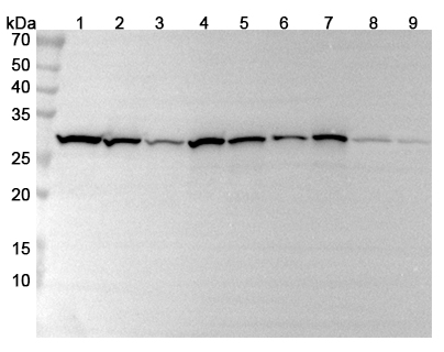 Anti-CACYBP Polyclonal antibody binds to CACYBP, N-His, recombinant protein in WB Assay