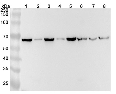 Anti-CCT5 Polyclonal Antibody binds to Human CCT5 Recombinant Protein, N-His in WB Assay
