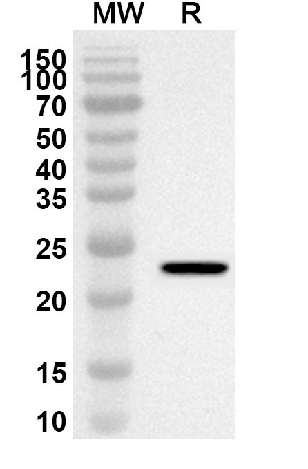 Anti-Human CD235a/GYPA Polyclonal Antibody binds to Recombinant Human CD235a/GYPA Protein, N-His-KSI in WB Assay