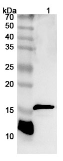 Anti-CD247/CD3Z Polyclonal Antibody binds to Recombinant Human CD247/CD3Z Protein, N-GST & C-His in WB Assay