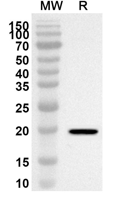 Anti-CD299/CLEC4M Polyclonal Antibody binds to Recombinant Human CD299/CLEC4M, N-His in WB Assay