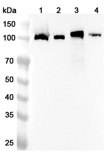 Anti-CD41/ITGA2B Polyclonal Antibody binds to Recombinant Human CD41/ITGA2B Protein, N-His in WB Assay