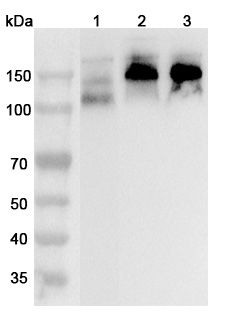 Anti-CD56/NCAM1 Polyclonal Antibody binds to CD56 Recombinant Protein in WB Assay