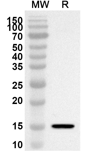 Anti-CD66d/CEACAM3 Polyclonal Antibody binds to CD66d recombinant protein in WB Assay