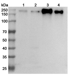 Anti-CD66e/CEA/CEACAM5 Polyclonal Antibody binds to CD66e Recombinant Protein in WB Assay
