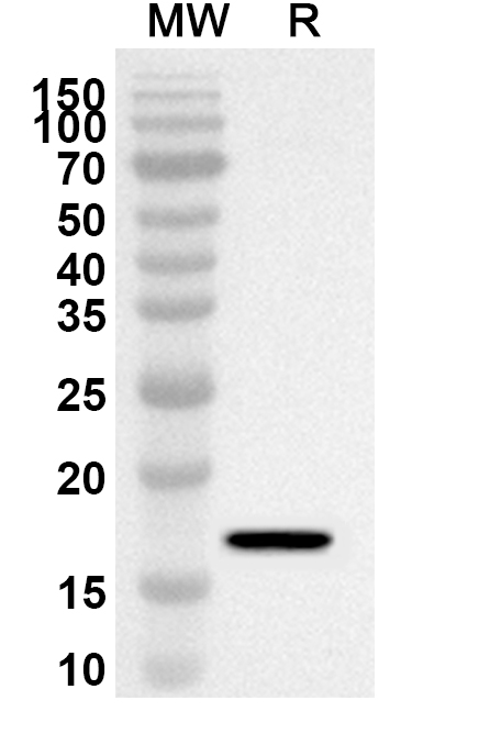 Anti-CD7 Polyclonal antibody binds to Recombinant Mouse CD7 Protein, N-GST & C-His in WB Assay