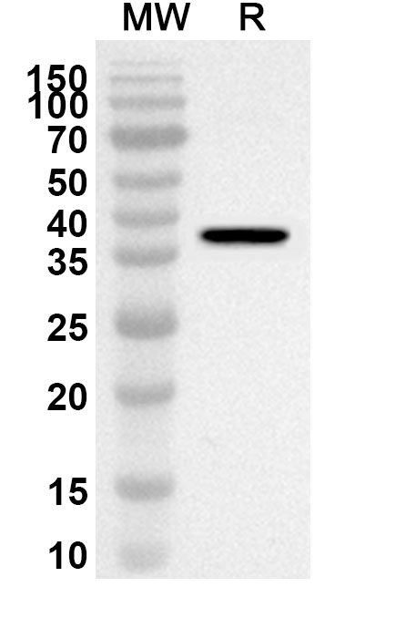Anti-CD77/A4GALT Polyclonal Antibody binds to Recombinant Human CD77/A4GALT, N-His in WB Assay