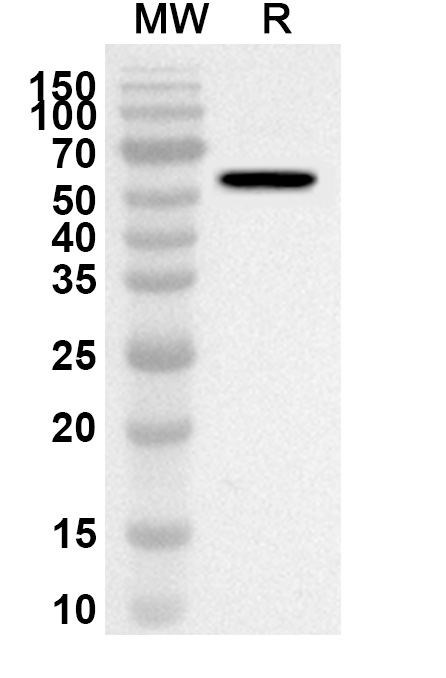 Anti-CELA3A Polyclonal antibody binds to Recombinant Human CELA3A, N-GST in WB Assay