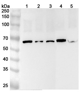 Anti-CETP Polyclonal antibody binds to Recombinant Human CETP, N-His in WB Assay