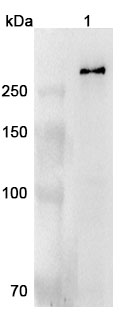 Anti-CHD4 Polyclonal Antibody binds to Human CHD4 Recombinant Protein, C-His in WB Assay