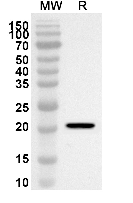 Anti-CHIKV Capsid Protein Polyclonal Antibody in WB Assay