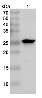 Anti-CHPV P/Phosphoprotein Polyclonal Antibody in WB Assay