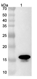 Anti-Clostridioides difficile Toxin A/tcdA VHH (SAA0993) binds to Clostridioides difficile Toxin A/tcdA Recombinant Protein, C-His in WB Assay
