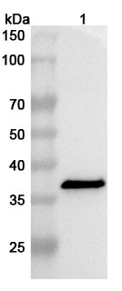 Anti-Clostridium perfringens cpb/Beta-toxin Polyclonal Antibody binds to Recombinant Clostridium perfringens cpb/Beta-toxin Protein, N-His in WB Assay