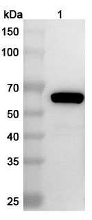 Anti-Clostridium perfringens pfo/Perfringolysin O/Theta-toxin Polyclonal Antibody binds to Recombinant Clostridium perfringens pfo/Perfringolysin O/Theta-toxin Protein, N-His in WB Assay