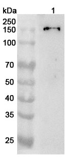 Anti-COL2A1 Polyclonal antibody binds to Recombinant Human COL2A1, N-His in WB Assay