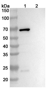 Anti-Corynephage omega DT/Diphtheria toxin Monoclonal Antibody, DTD8 in WB Assay