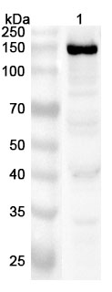 Anti-CPS1 Polyclonal Antibody binds to Human CPS1 Recombinant Protein, N-His in WB Assay