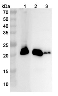 Anti-CSRP3 Polyclonal Antibody binds to Recombinant Human CSRP3 Protein, N-His in WB Assay