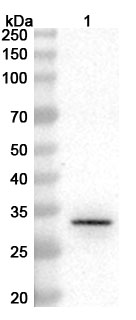 Anti-Cutibacterium acnes PPA2105/Triacylglycerol lipase Polyclonal Antibody binds to Recombinant Cutibacterium acnes PPA2105/Triacylglycerol lipase Protein, N-MAT in WB Assay
