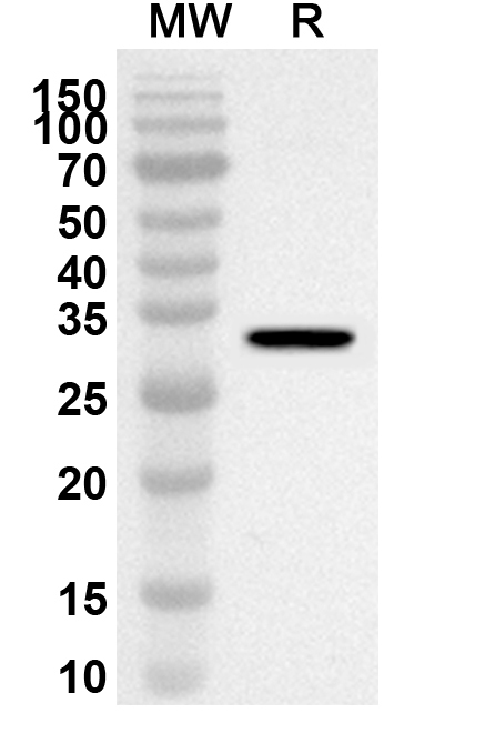 Anti-DCLK1 Polyclonal Antibody binds to Recombinant Human DCLK1, N-His in WB Assay