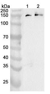 Anti-DHX9 Polyclonal Antibody binds to Human DHX9 Recombinant Protein, N-His in WB Assay