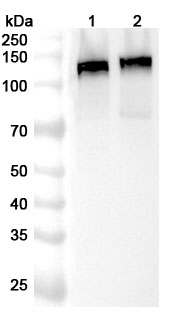 Anti-DLG1 Polyclonal Antibody binds to Recombinant Human DLG1 Protein, N-His in WB Assay