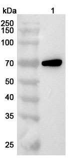 Anti-DMPK Polyclonal Antibody binds to Recombinant Human DMPK Protein, N-His in WB Assay