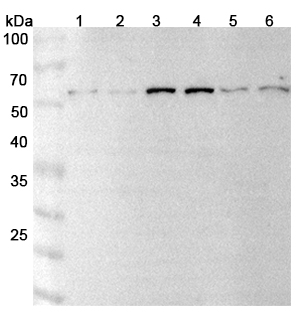 Anti-ECE1 Polyclonal Antibody binds to Recombinant Human ECE1, N-His in WB Assay