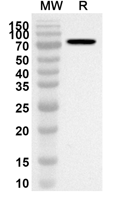 Anti-EFEMP2 Polyclonal antibody binds to Recombinant Human EFEMP2, N-GST in WB Assay