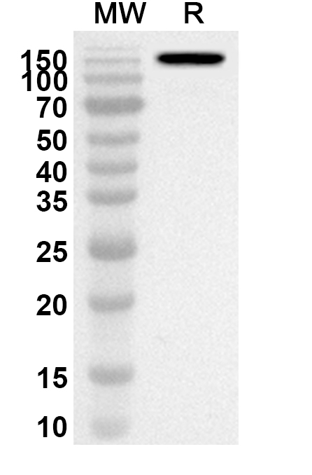 Anti-Etanercept Polyclonal Antibody in WB Assay