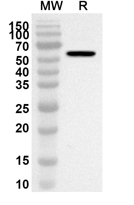 Anti-Evolocumab Polyclonal Antibody in WB Assay