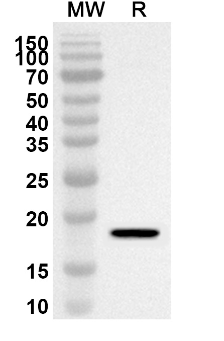 Anti-EZH2 Polyclonal Antibody binds to EZH2 Protein, N-His, recombinant protein in WB Assay