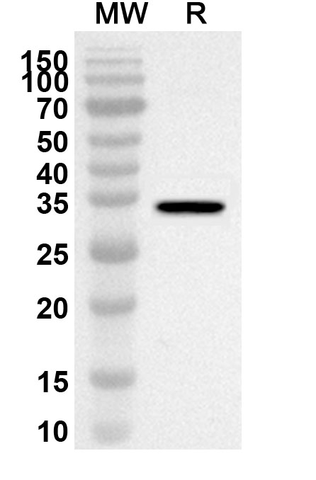 Anti-FASN Polyclonal Antibody binds to Recombinant Human FASN, N-His in WB Assay